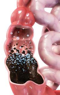 Oxygen Colon Cleanse